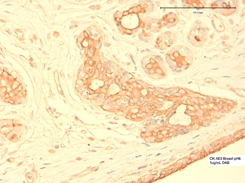 Cytokeratin (pan) basic type 2 Mouse Monoclonal Antibody
