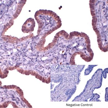 Cytokeratin 3 Monoclonal Antibody