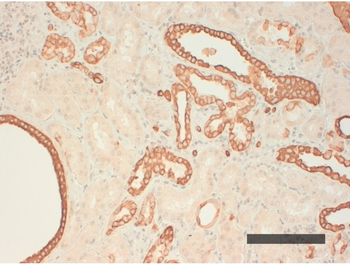 Cytokeratin (Types 10, 14, 15, 16, 19) Monoclonal Antibody