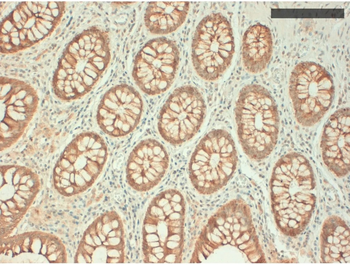 Cytokeratin (Types 10, 14, 15, 16, 19) Monoclonal Antibody