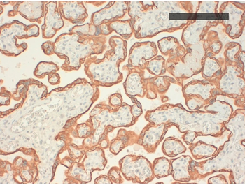 Cytokeratin (Types 10, 14, 15, 16, 19) Monoclonal Antibody