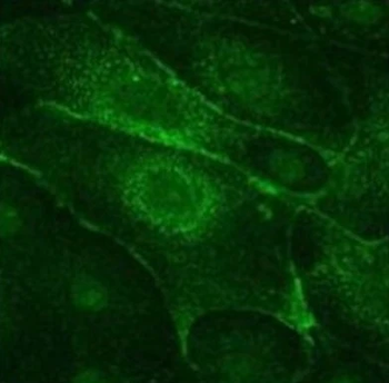 Dopamine Transporter Monoclonal Antibody