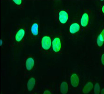Emerin Monoclonal Antibody