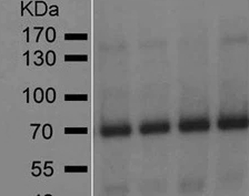 GAD65 Monoclonal Antibody