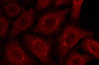 gp210 Antibody