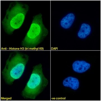 Histone H3 (tri methyl K9) Monoclonal Antibody