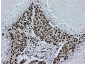 hnRNP A2B1 Monoclonal Antibody