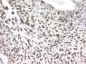 hnRNP A2B1 Monoclonal Antibody