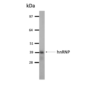 hnRNP A2B1 Monoclonal Antibody