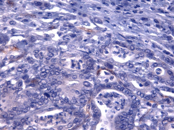 Interferon gamma Monoclonal Antibody