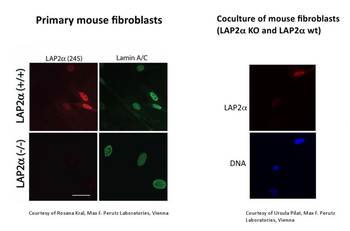 LAP2 alpha Antibody
