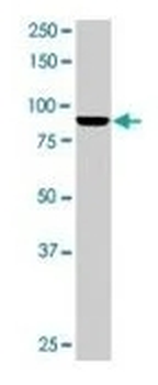 Mad1 Monoclonal Antibody