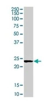 Mad2L1 Monoclonal Antibody