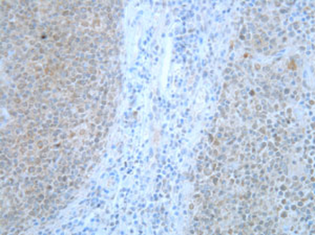 Mad2L1 Monoclonal Antibody