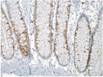 Mad2L1 Monoclonal Antibody