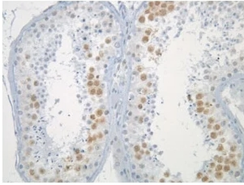 Mad2L1 Monoclonal Antibody