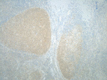 Mad2L1 Monoclonal Antibody