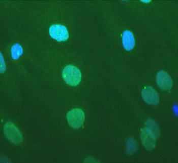 Nesprin 1 Monoclonal Antibody