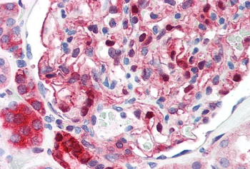 NQO1 Monoclonal Antibody