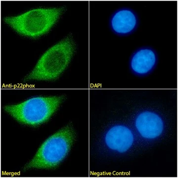 Cytochrome b245 Alpha Light Chain/p22-phox Monoclonal Antibody