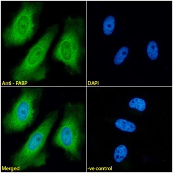 PABP Monoclonal Antibody