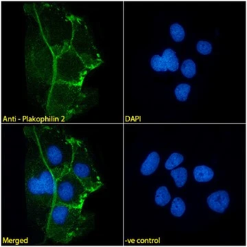 Plakophilin 2 Monoclonal Antibody