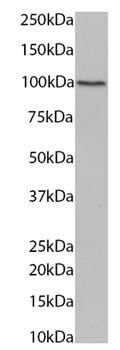 Plakophilin 2 Mouse Monoclonal Antibody