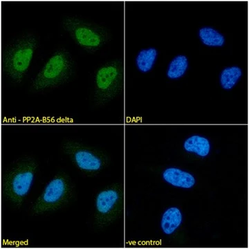 PP2A-B56 delta Monoclonal Antibody