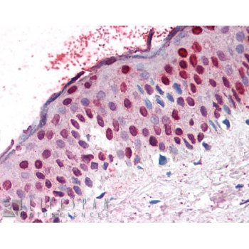 RanGAP1 Antibody