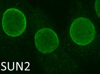 SUN2 Antibody