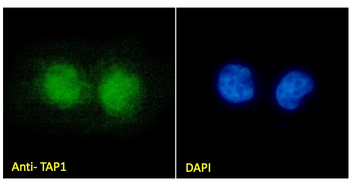 TAP1 Monoclonal Antibody
