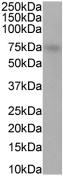 TAP1 Monoclonal Antibody