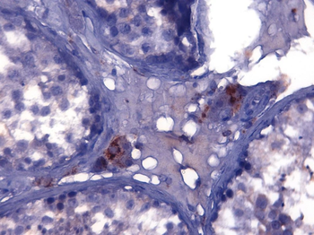 Testosterone Monoclonal Antibody