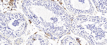 Testosterone Monoclonal Antibody