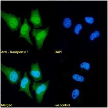 Transportin 1/MIP Monoclonal Antibody