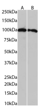 Transportin 1/MIP Monoclonal Antibody