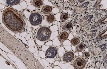 Trichohyalin Monoclonal Antibody