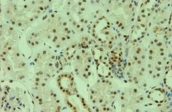 Y14 Monoclonal Antibody