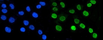Anti-Aryl hydrocarbon Receptor/AHR Antibody