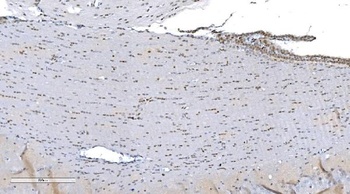 Anti-Aryl hydrocarbon Receptor/AHR Antibody