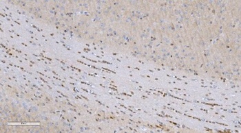 Anti-Aryl hydrocarbon Receptor/AHR Antibody
