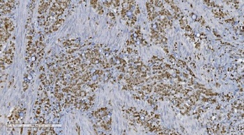 Anti-Aryl hydrocarbon Receptor/AHR Antibody