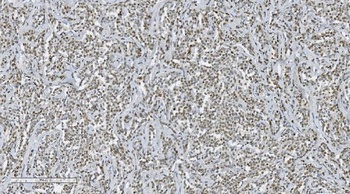 Anti-Aryl hydrocarbon Receptor/AHR Antibody