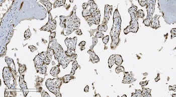 Anti-Aryl hydrocarbon Receptor/AHR Antibody