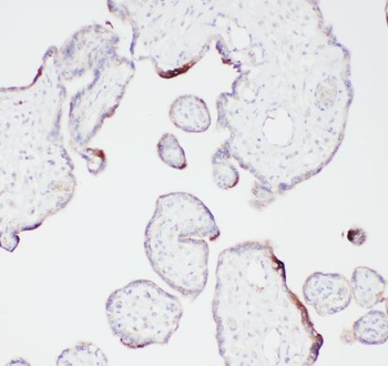 Anti-Angiostatin K1-3/PLG Antibody