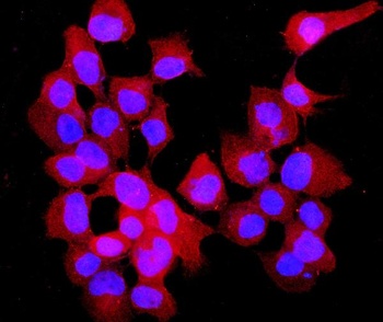 Anti-Annexin VII/ANXA7 Antibody