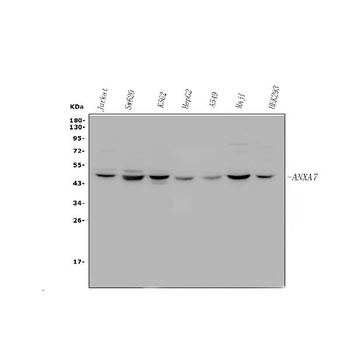 Anti-Annexin VII/ANXA7 Antibody