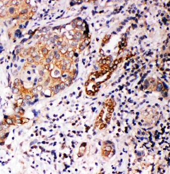 Anti-Annexin A10/ANXA10 Antibody