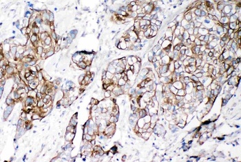 VE-Cadherin CDH5-Antibody