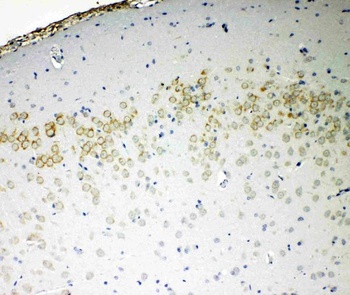 Anti-VE-Cadherin CDH5-Antibody